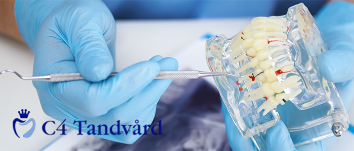 C4 Tandv&aring;rd - 10 % rabatt p&aring; alla behandlingar